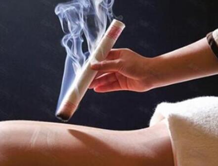 艾条商标应注册在哪个类别？